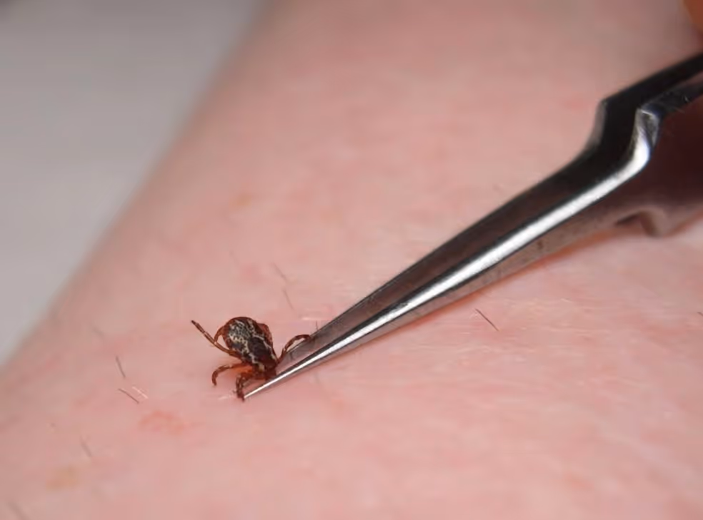 Tick Extermination in Trinity, TX