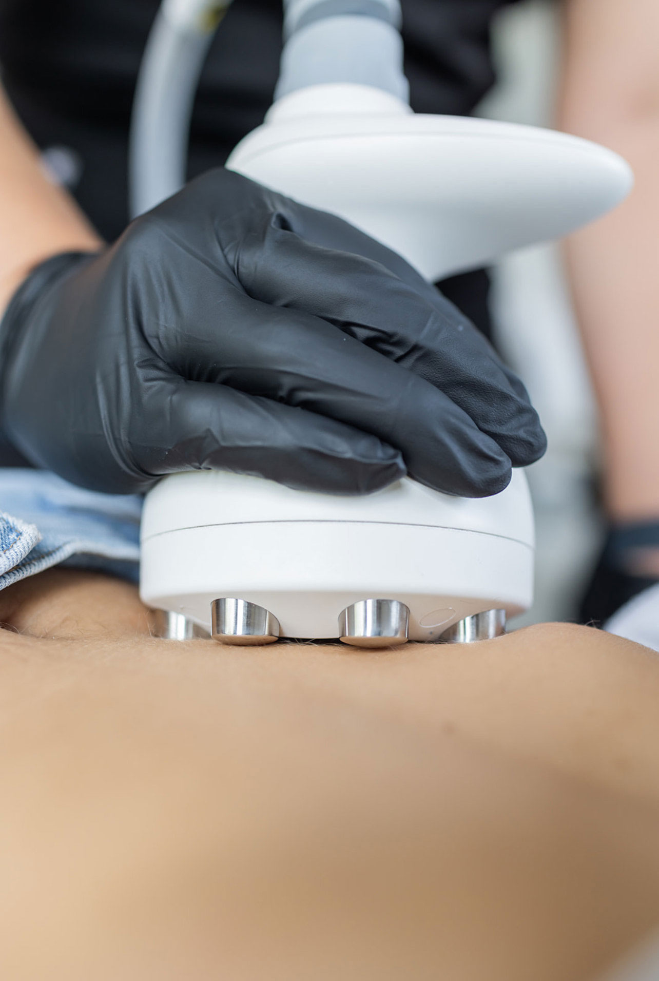 A close-up of a gloved hand using an advanced machine to perform a professional cellulite treatment on a client's body.