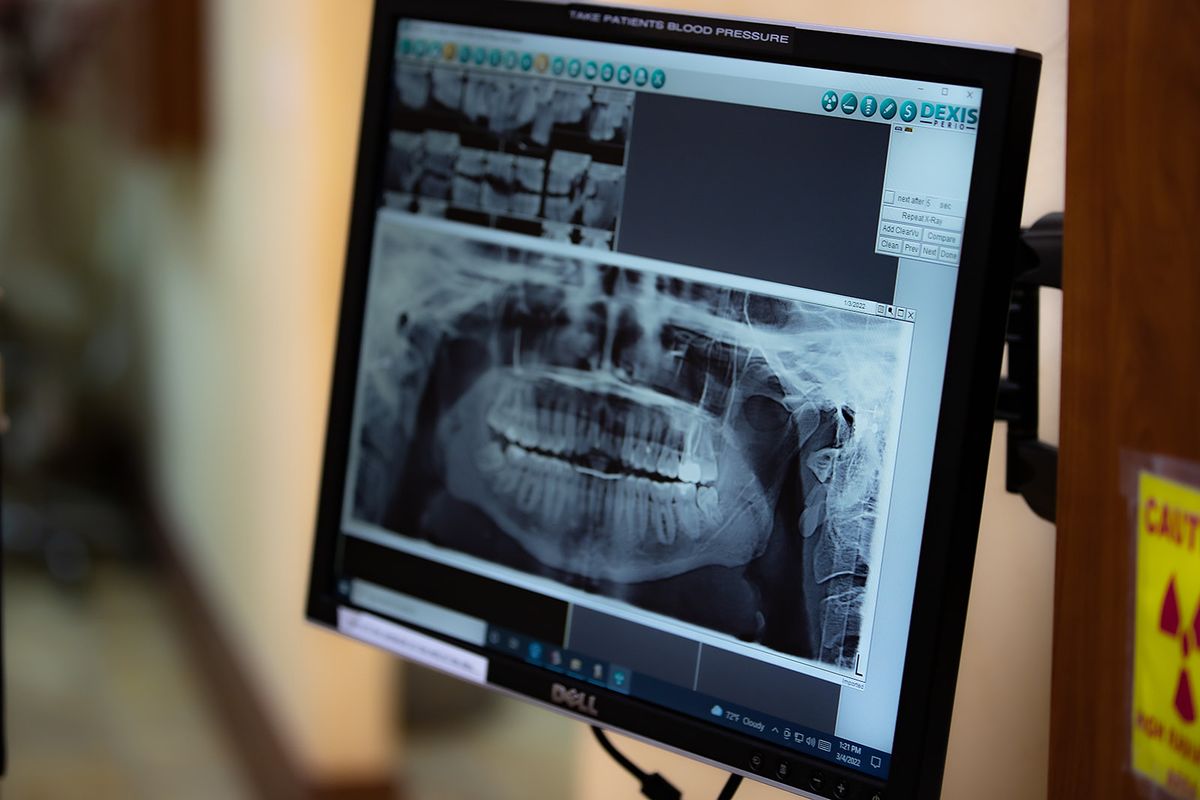 Panoramic imaging on screen at The Smile Designer