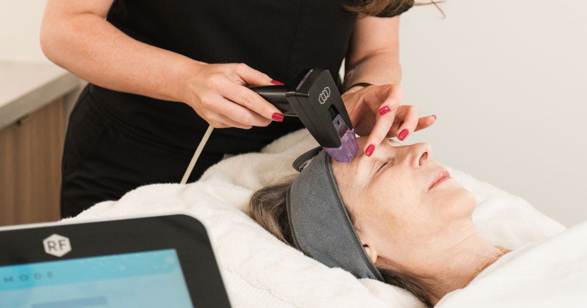 Morpheus RF Microneedling