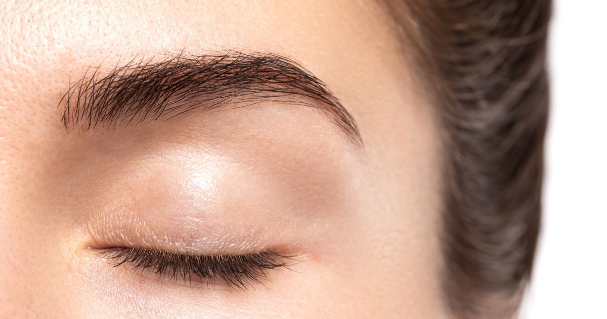 Brow Lift