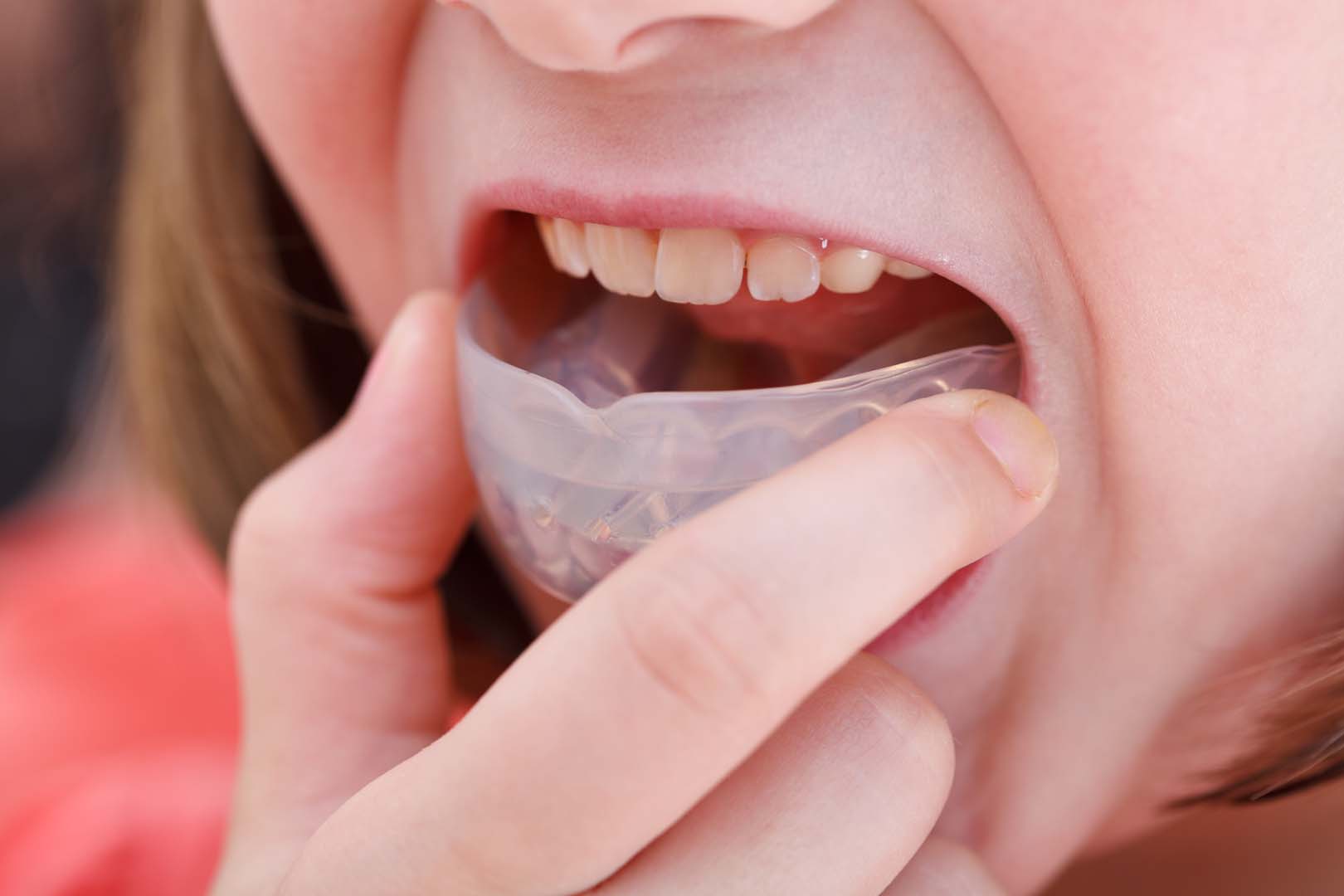Retainers & Guards
