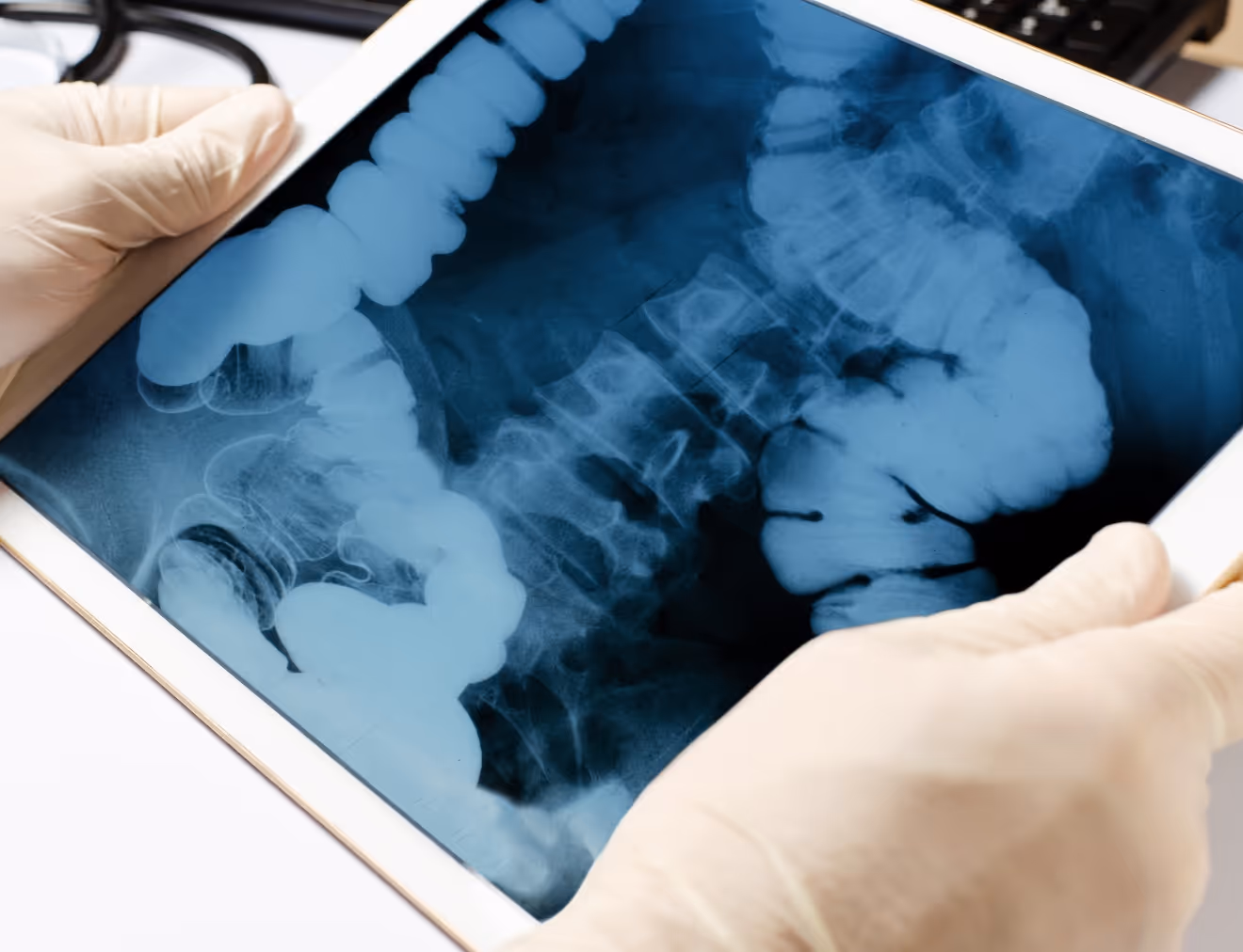 Person in Los Angeles showing GI x-ray on tablet; colon screenings, early detection, proactive steps