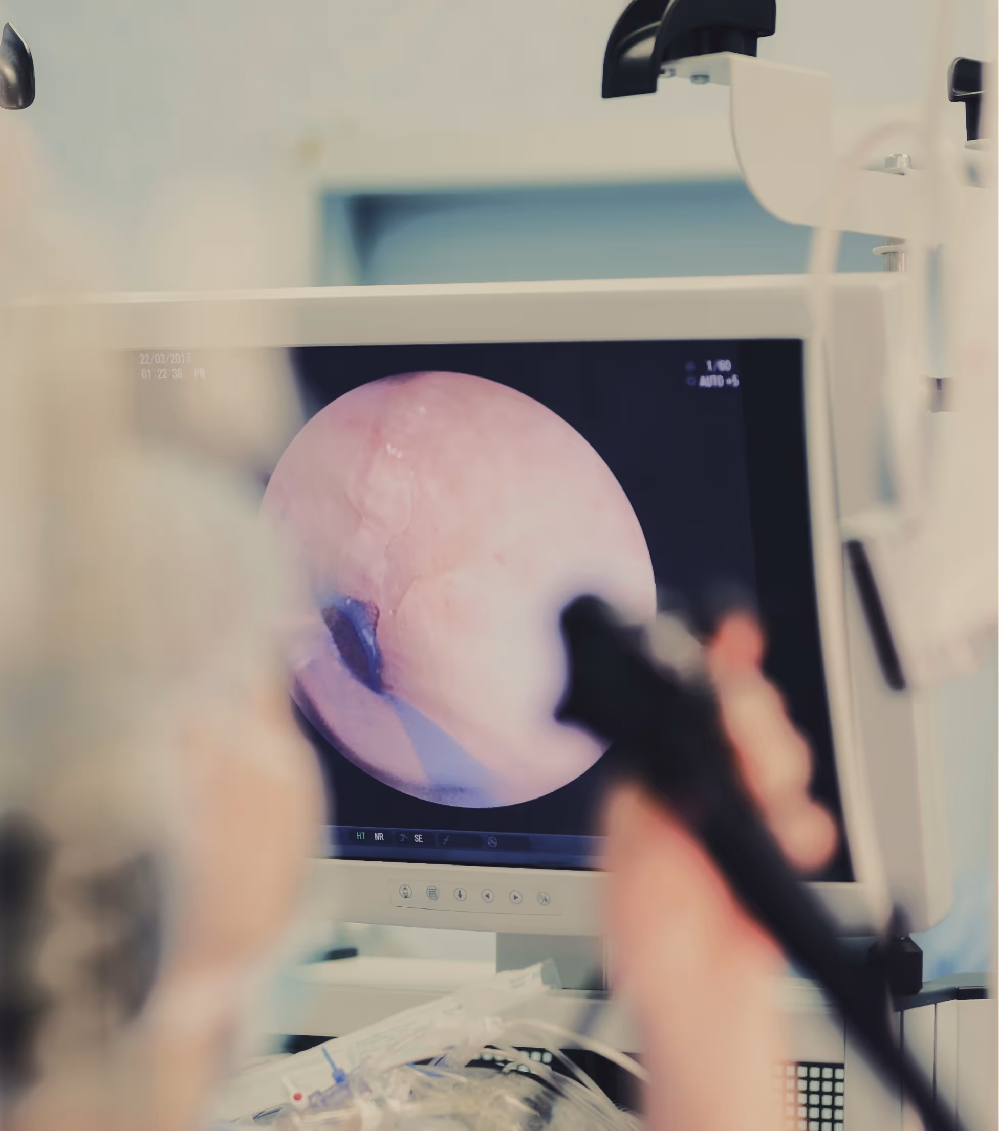 Doctor in Los Angeles doing preventative screening, examining blood in stool for cancer signs.