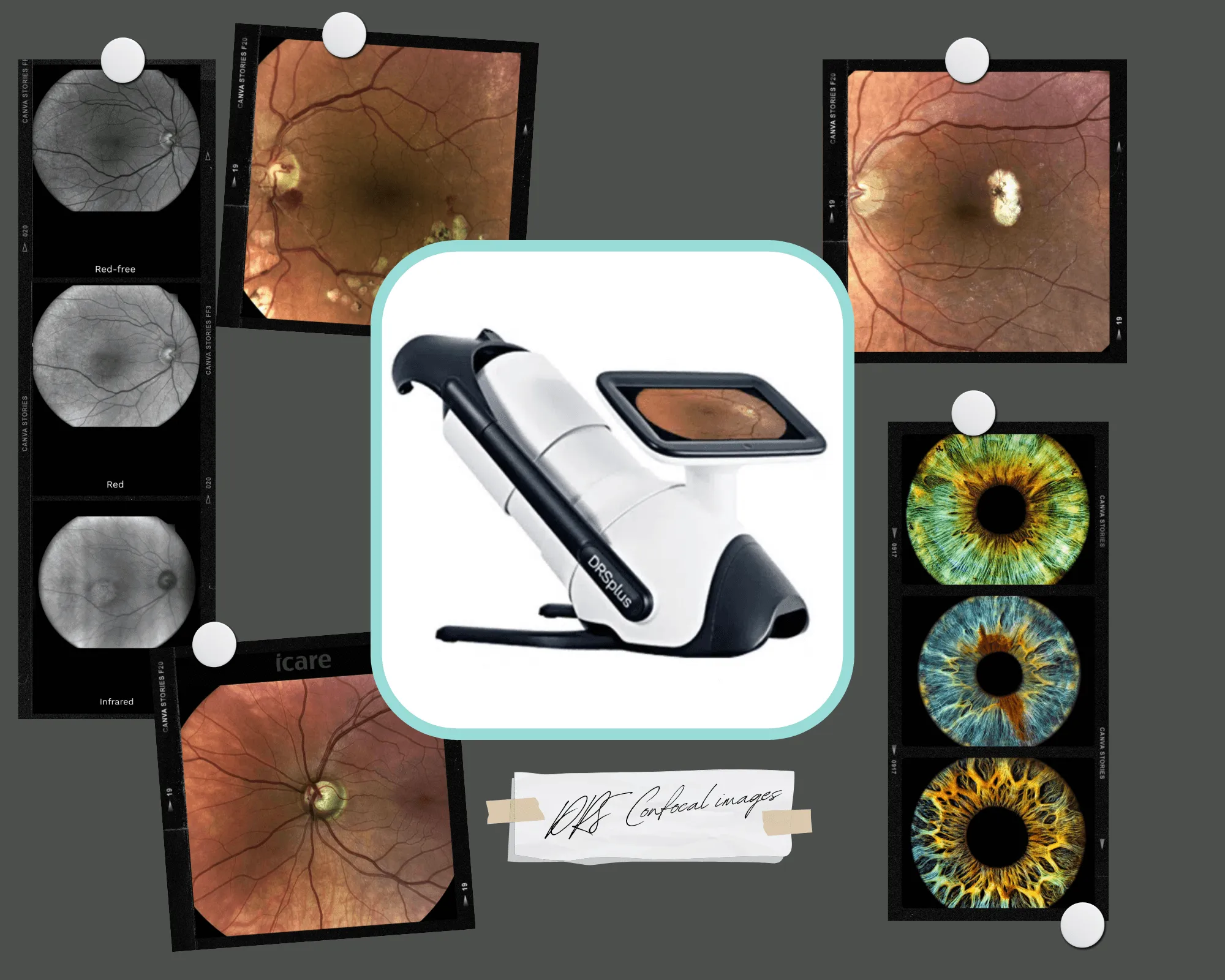 Ophthalmologic device with retinal scans and eye images in background