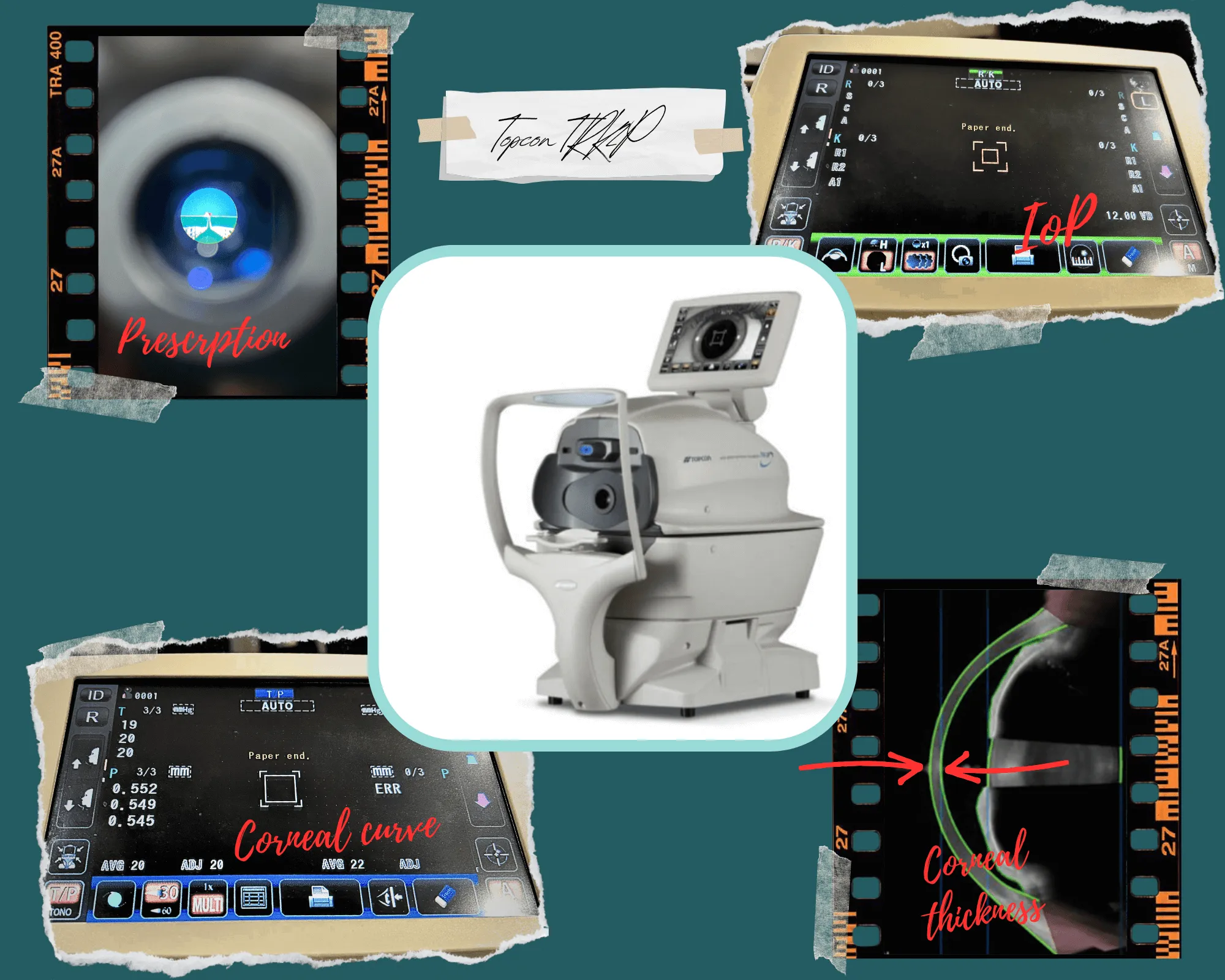 Advanced ophthalmology equipment for eye prescription and corneal measurement