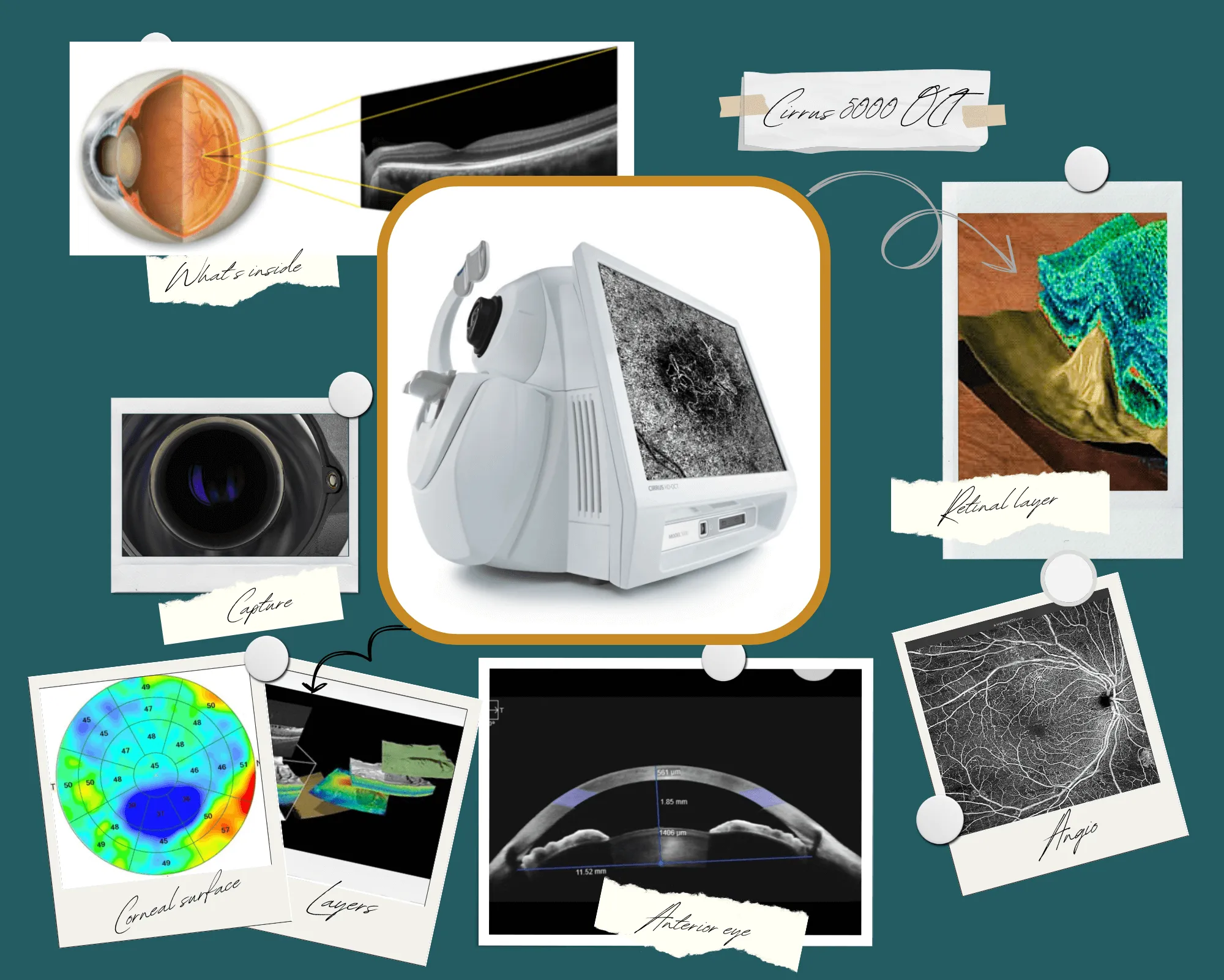 Eye diagnostic machine with various anatomical and imaging scans of human eye