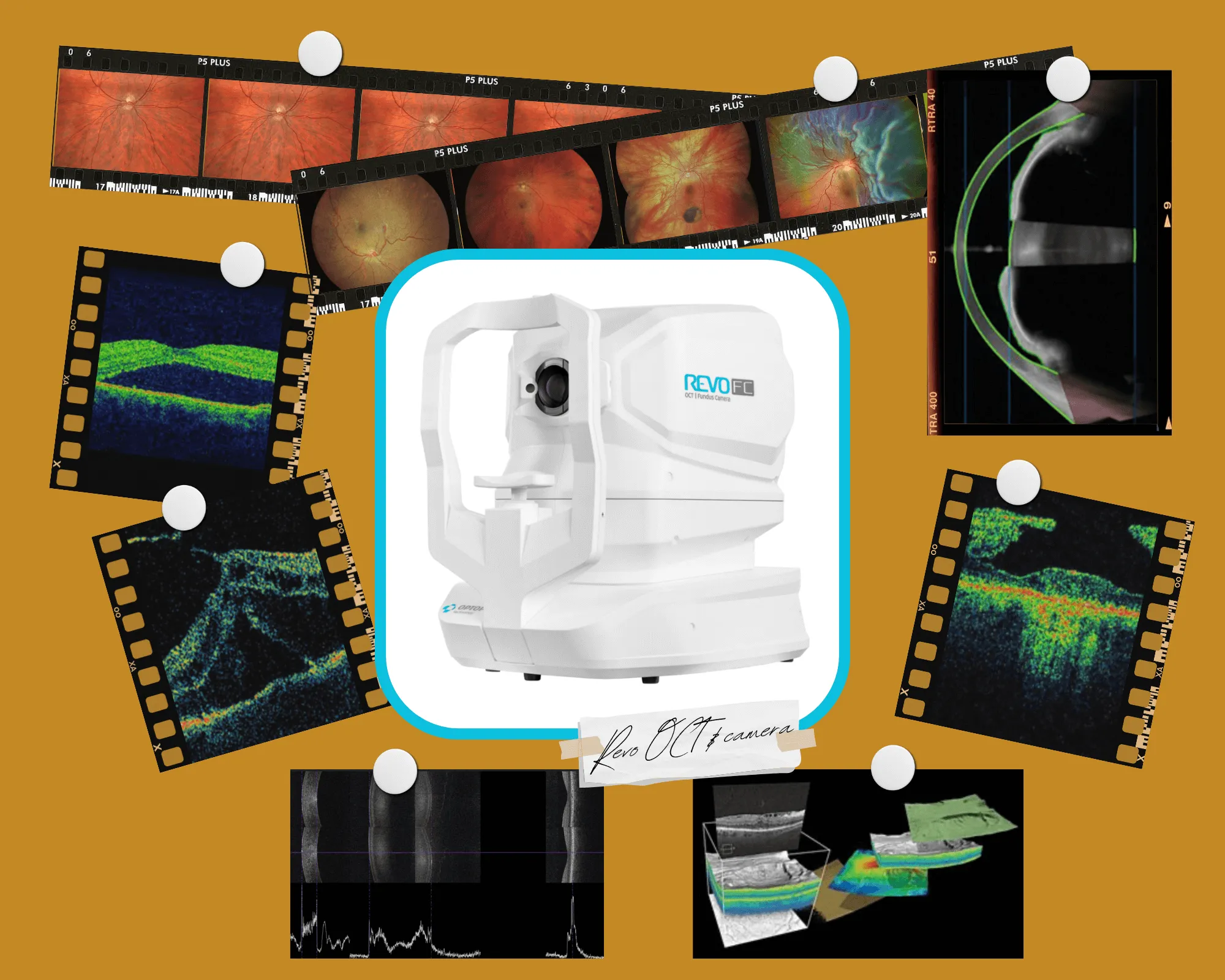 Revo OCT camera with retinal scans and eye imaging diagnostic images