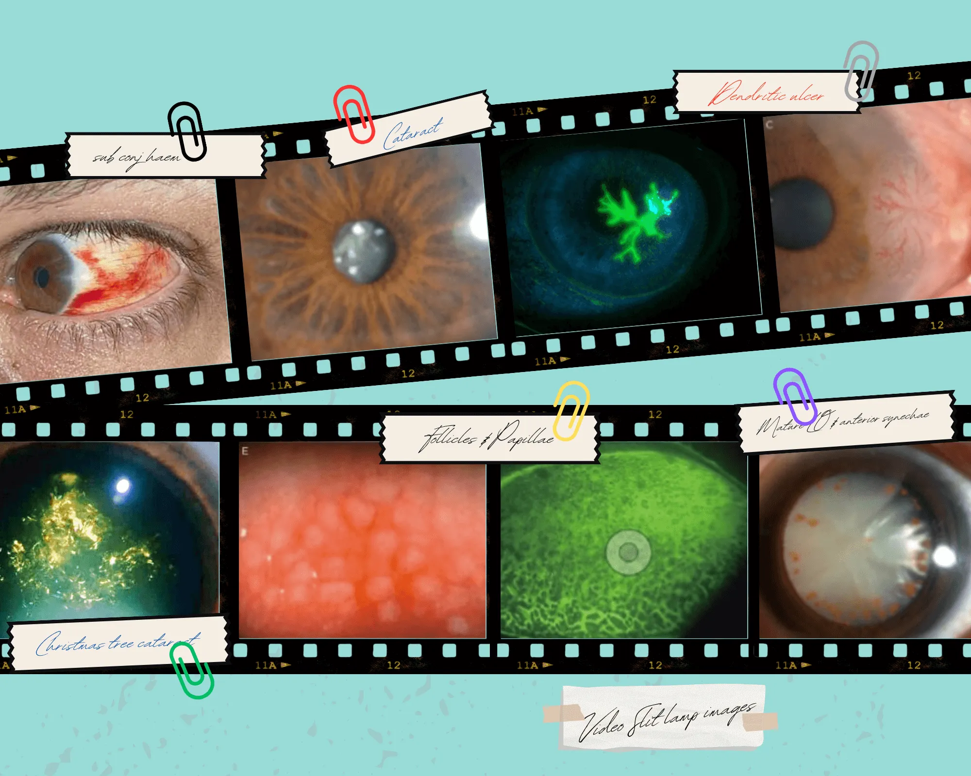 Medical images of eyes showing various conditions and microscopic views