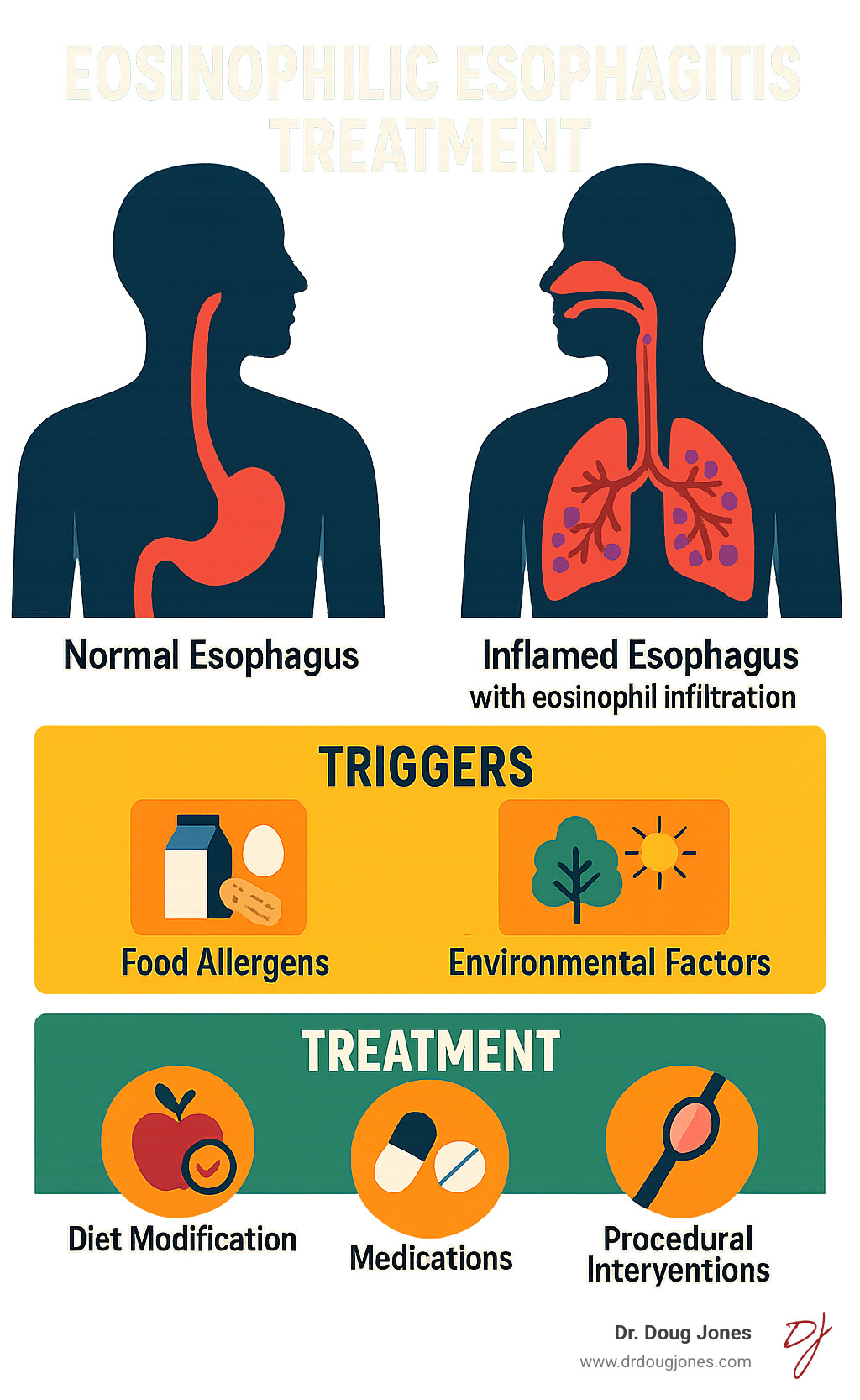 Comprehensive infographic showing the pathophysiology of eosinophilic esophagitis, including normal esophagus anatomy versus inflamed esophagus with eosinophil infiltration, common triggers like food allergens and environmental factors, and the three main treatment pillars of diet modification, medications, and procedural interventions - Eosinophilic esophagitis treatment infographic Comprehensive infographic showing the pathophysiology of eosinophilic esophagitis, including normal esophagus anatomy versus inflamed esophagus with eosinophil infiltration, common triggers like food allergens and environmental factors, and the three main treatment pillars of diet modification, medications, and procedural interventions - Eosinophilic esophagitis treatment infographic