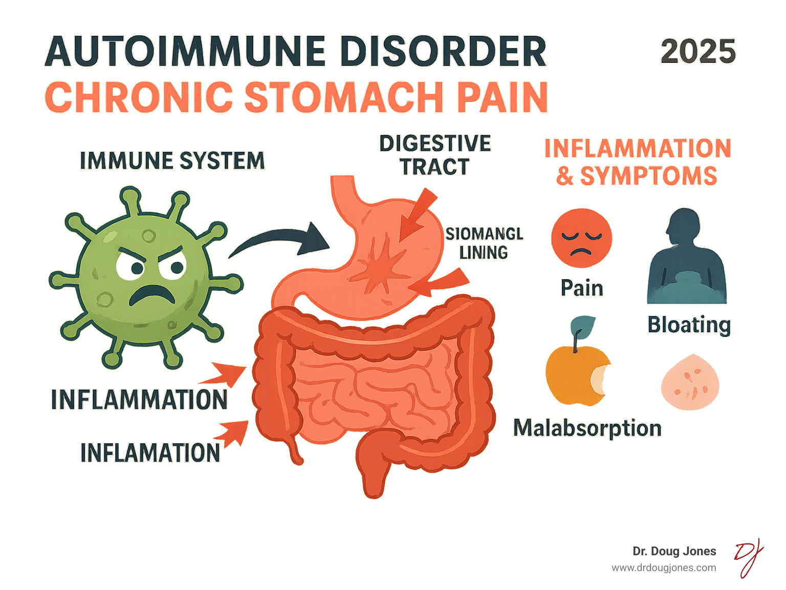 Infographic showing the immune system mistakenly attacking different parts of the digestive tract, including the stomach lining, small intestine, and colon, with arrows indicating inflammation and symptoms like pain, bloating, and malabsorption - auto immune disorder chronic stomach pain infographic 