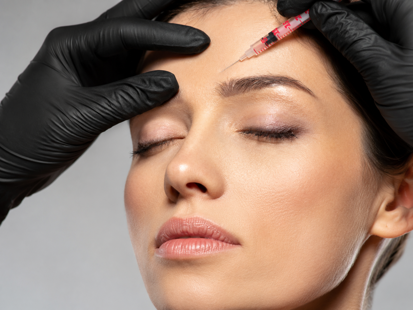Mésolift Mesopeel