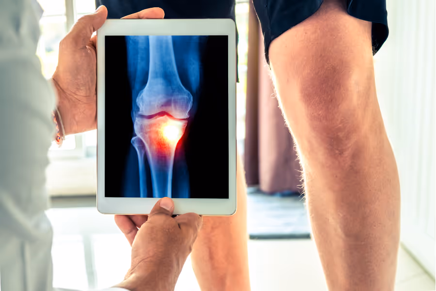 surgeon holding up xray to knee