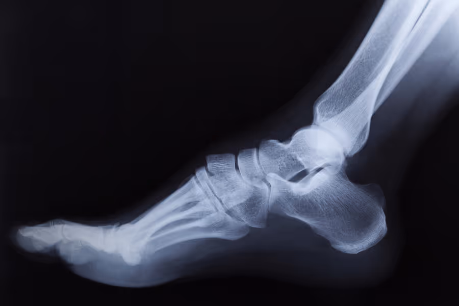 foot and ankle xray