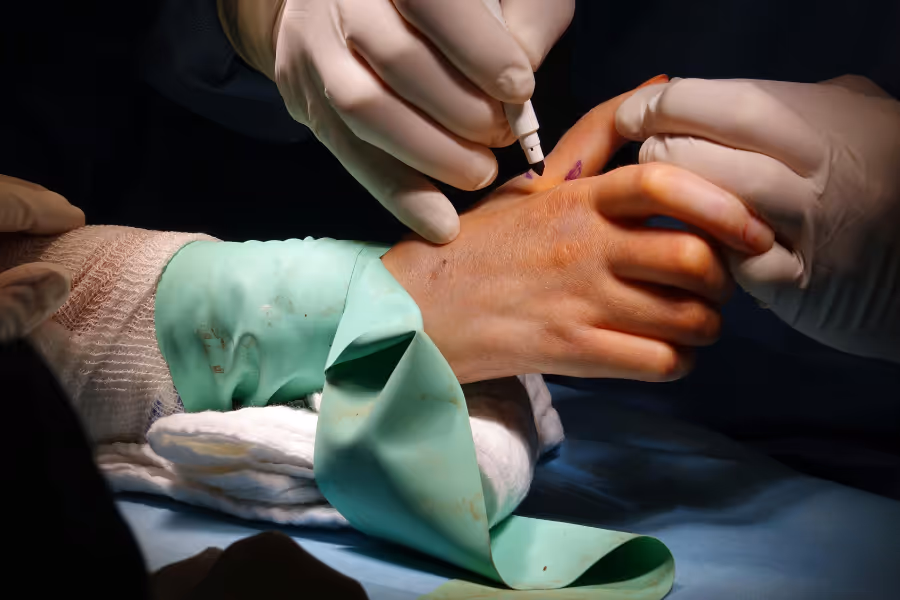 surgeon making surgery marks on patients wrist
