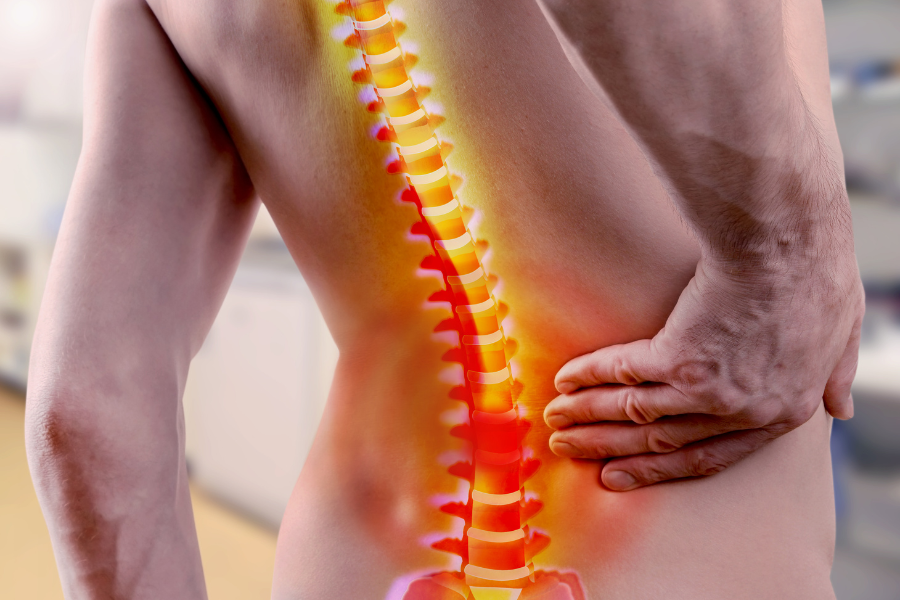 Visualization of pinched nerve in lower back