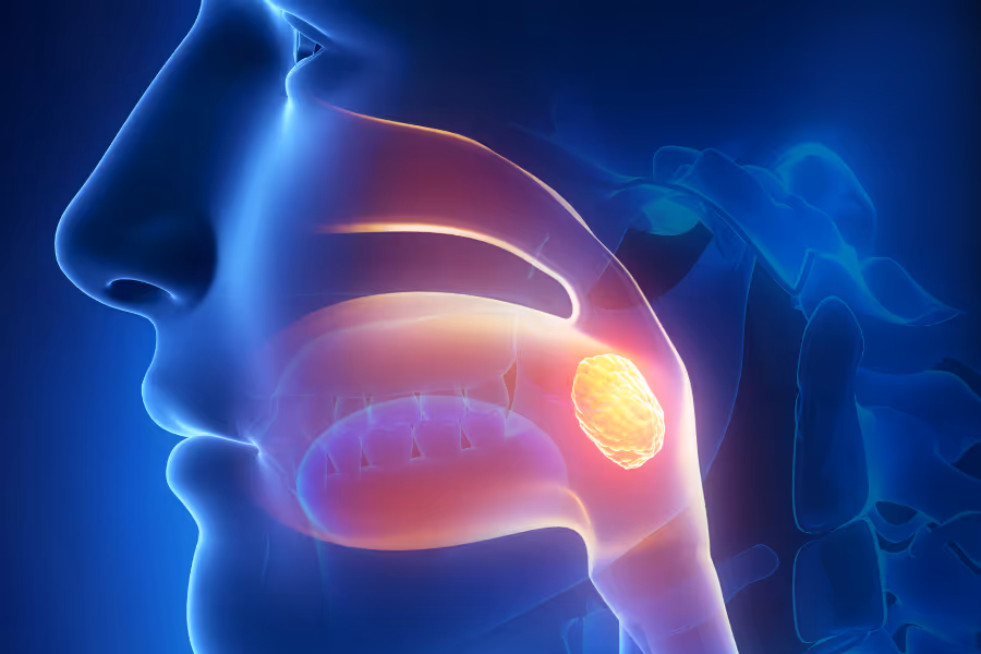 Tonsils side-view visualization