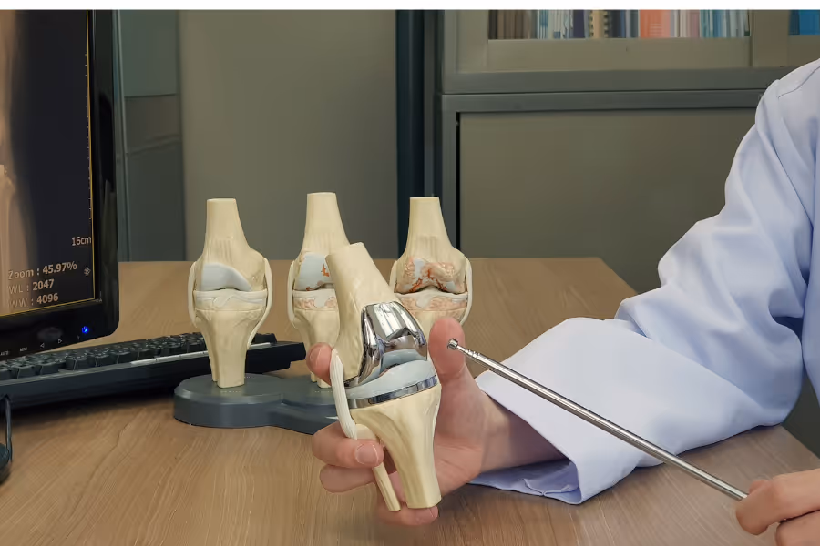 Orthopedic surgeon pointing to model of total knee replacement