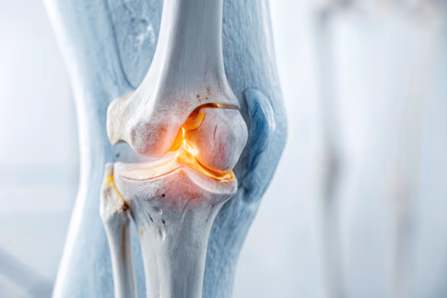 Knee joint visualization