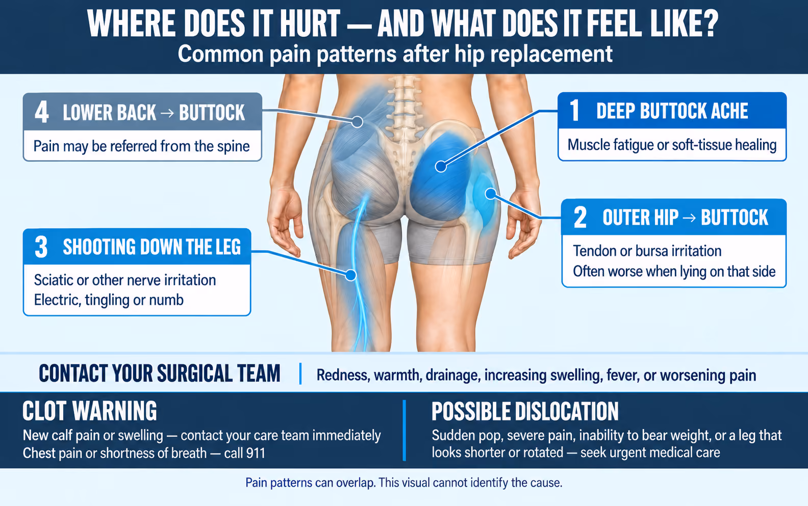 Medical infographic showing common buttock pain patterns after hip replacement, including muscle soreness, bursitis, sciatica and referred back pain, with clot and dislocation warning signs.