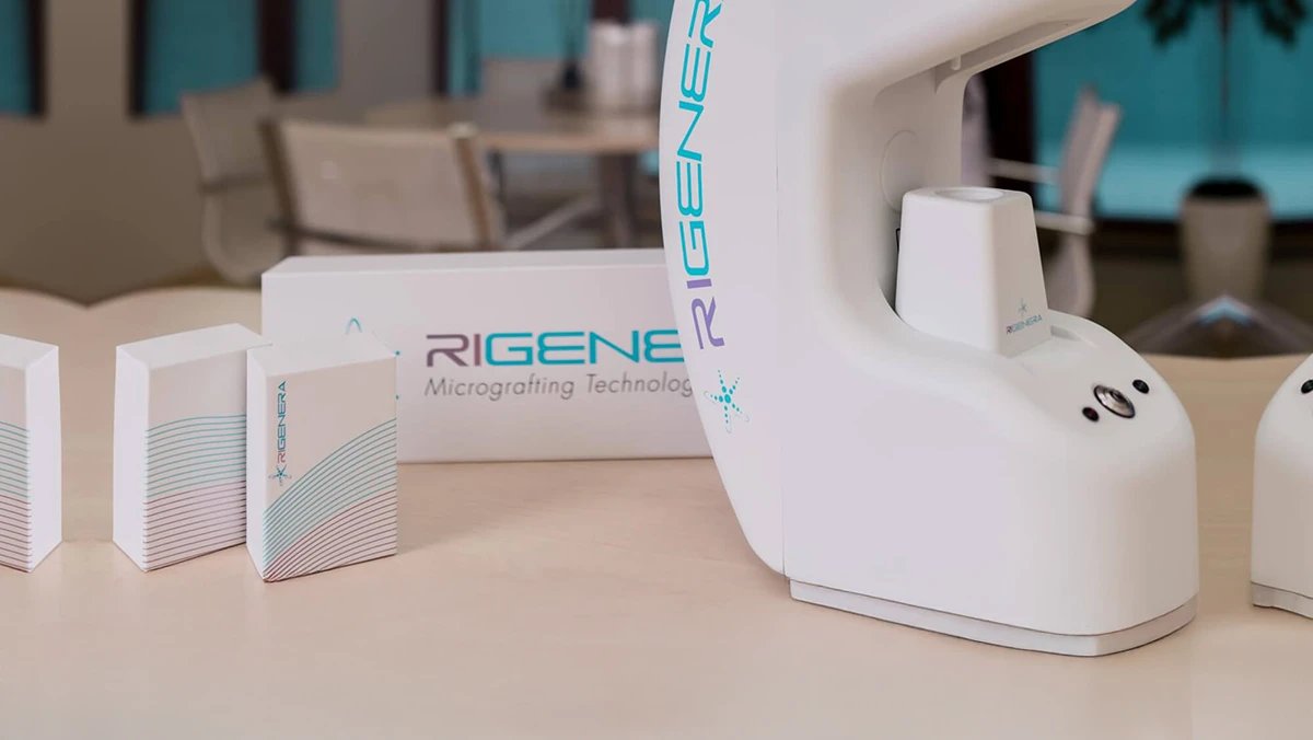 Přirozená metoda, využívá vlastní buňky, žádná cizí těla