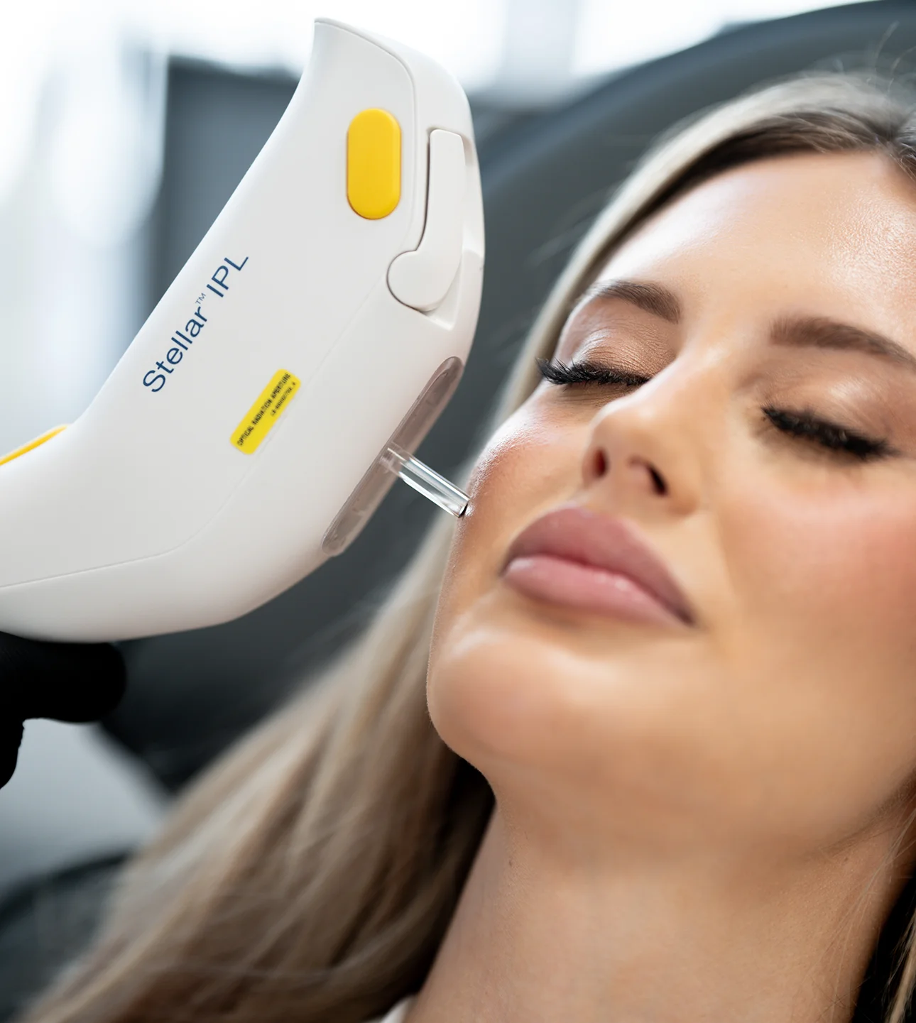 Laser Treatments
