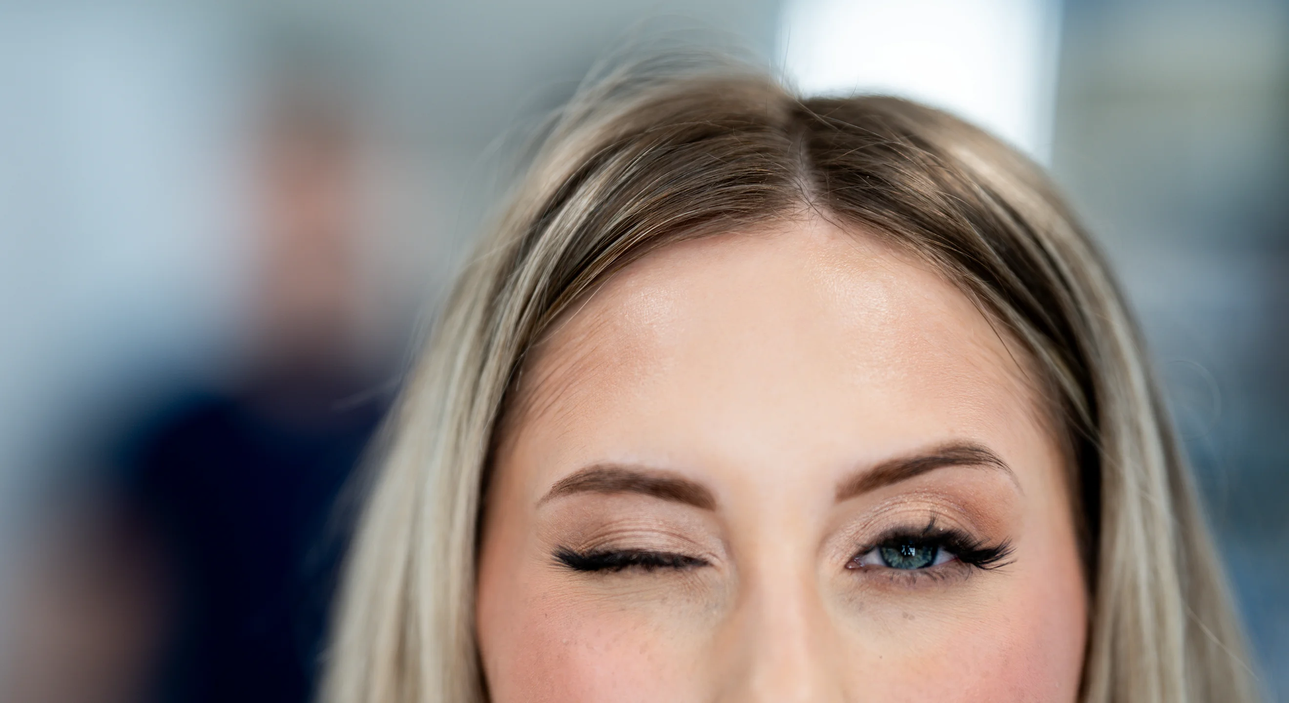 Blepharoplasty | Eternal Clinic