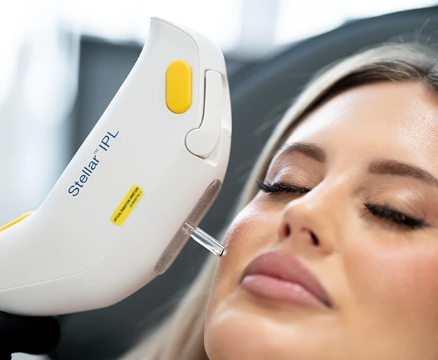 Laser Treatments