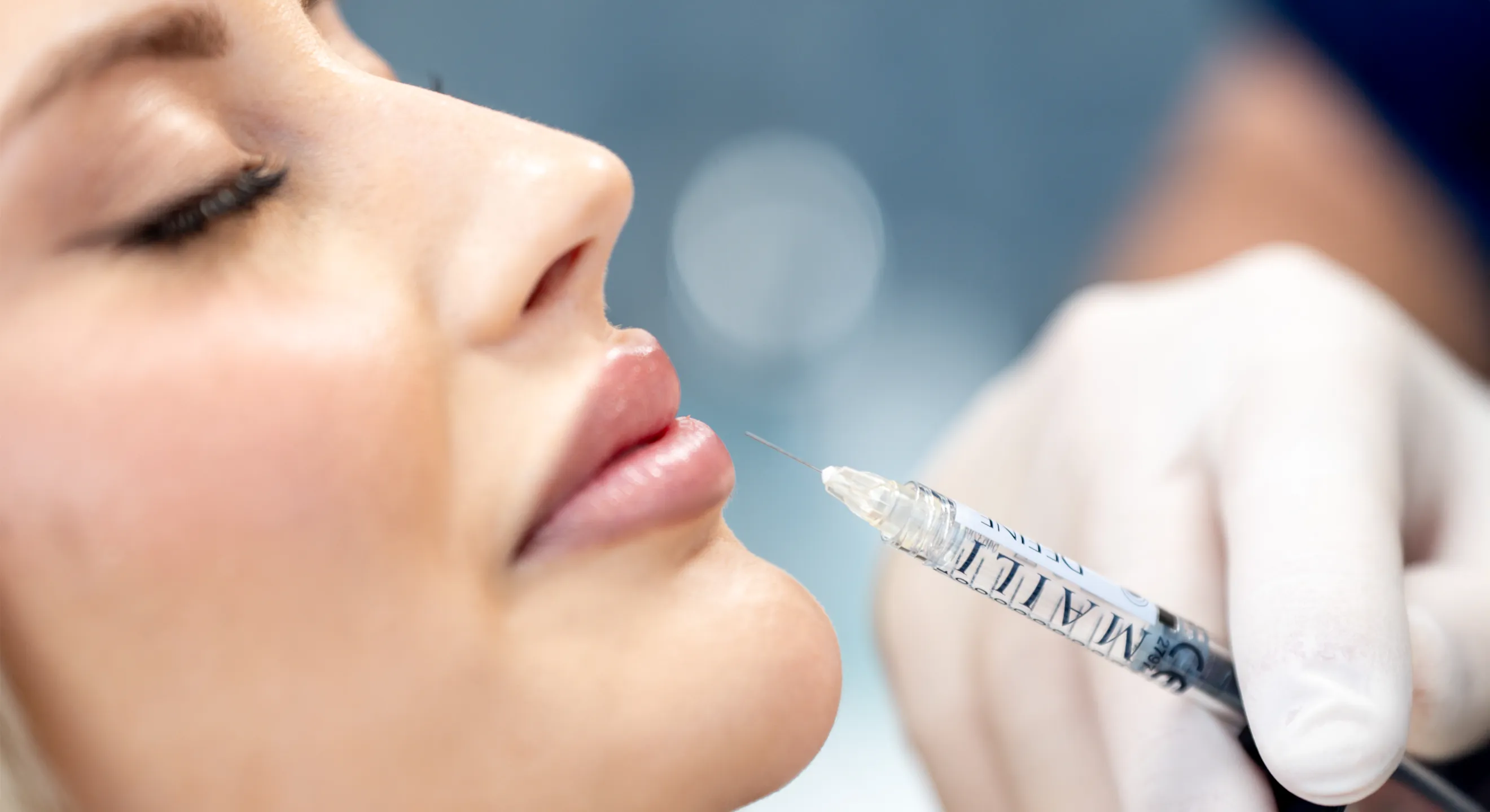 Aplikace dermálních výplní v estetické medicíně