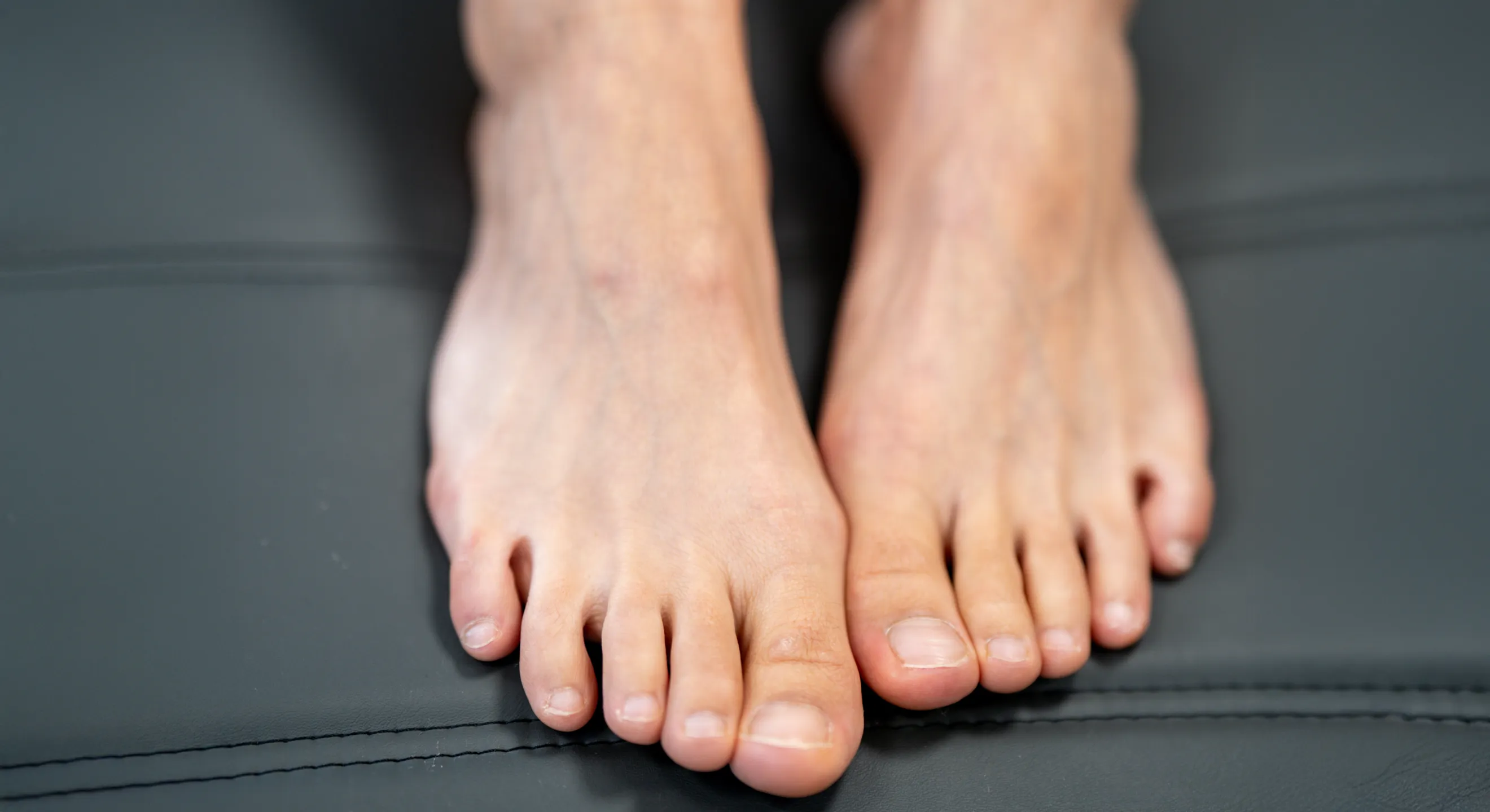 Ingrown Toenail Treatment