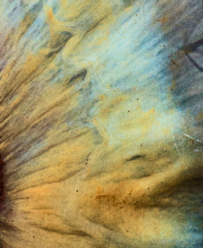 Surgical Robotics Dream Team Tackles Biggest Global Problem in Ophthalmology