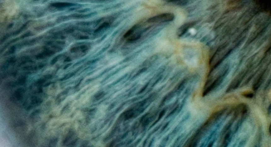 Four Ways Artificial Intelligence Can Benefit Robotic Surgery