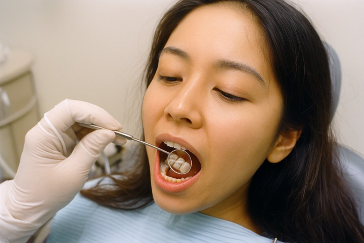 What’s the Difference Between Silver and Tooth-Colored Fillings