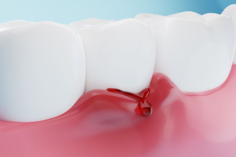 Can Gum Disease Affect Your Heart? What Lucas Patients Should Know