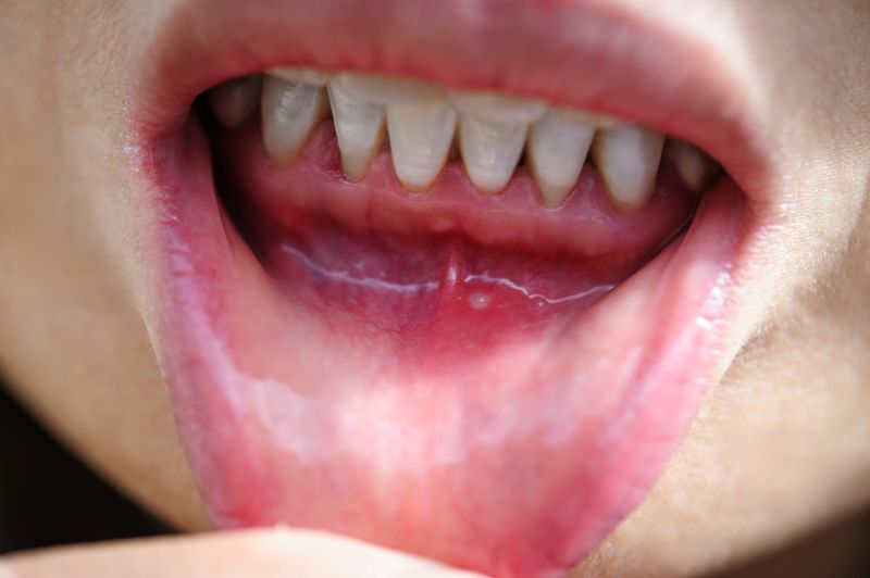 Why Are My Gums Receding?