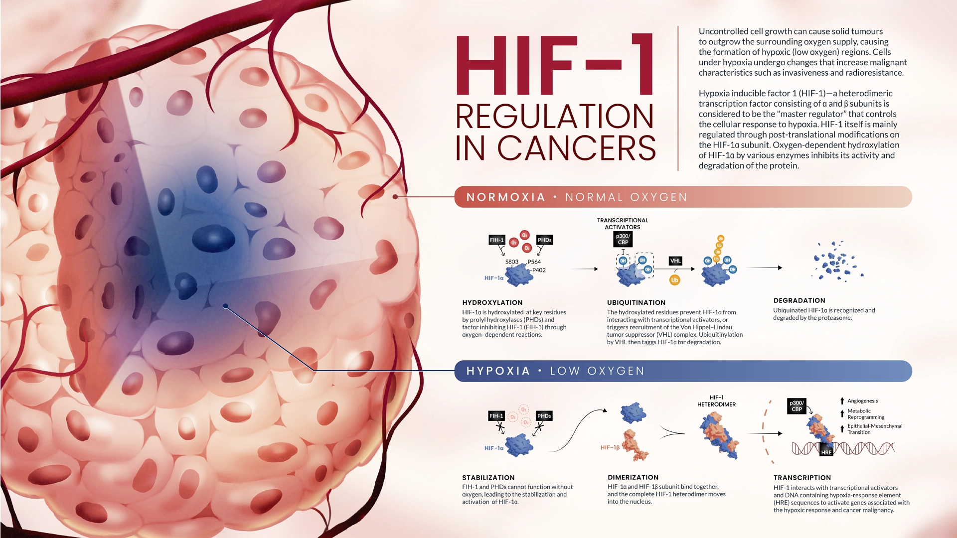 An infographic describing the regulation of HIF-1 in tumour hypoxia.