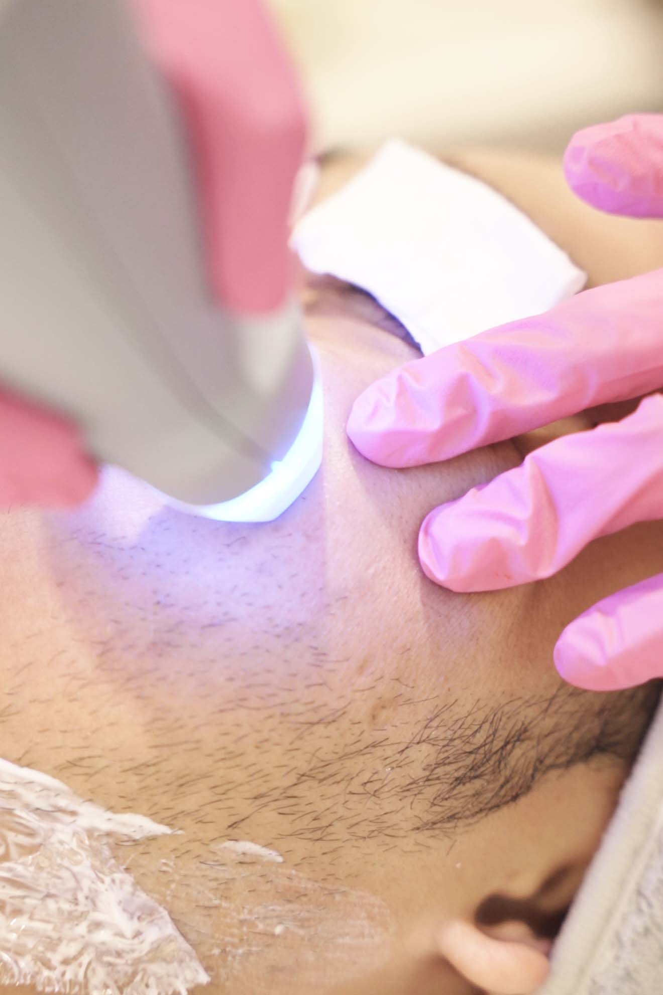 Handheld light-based device treating skin on the underarm