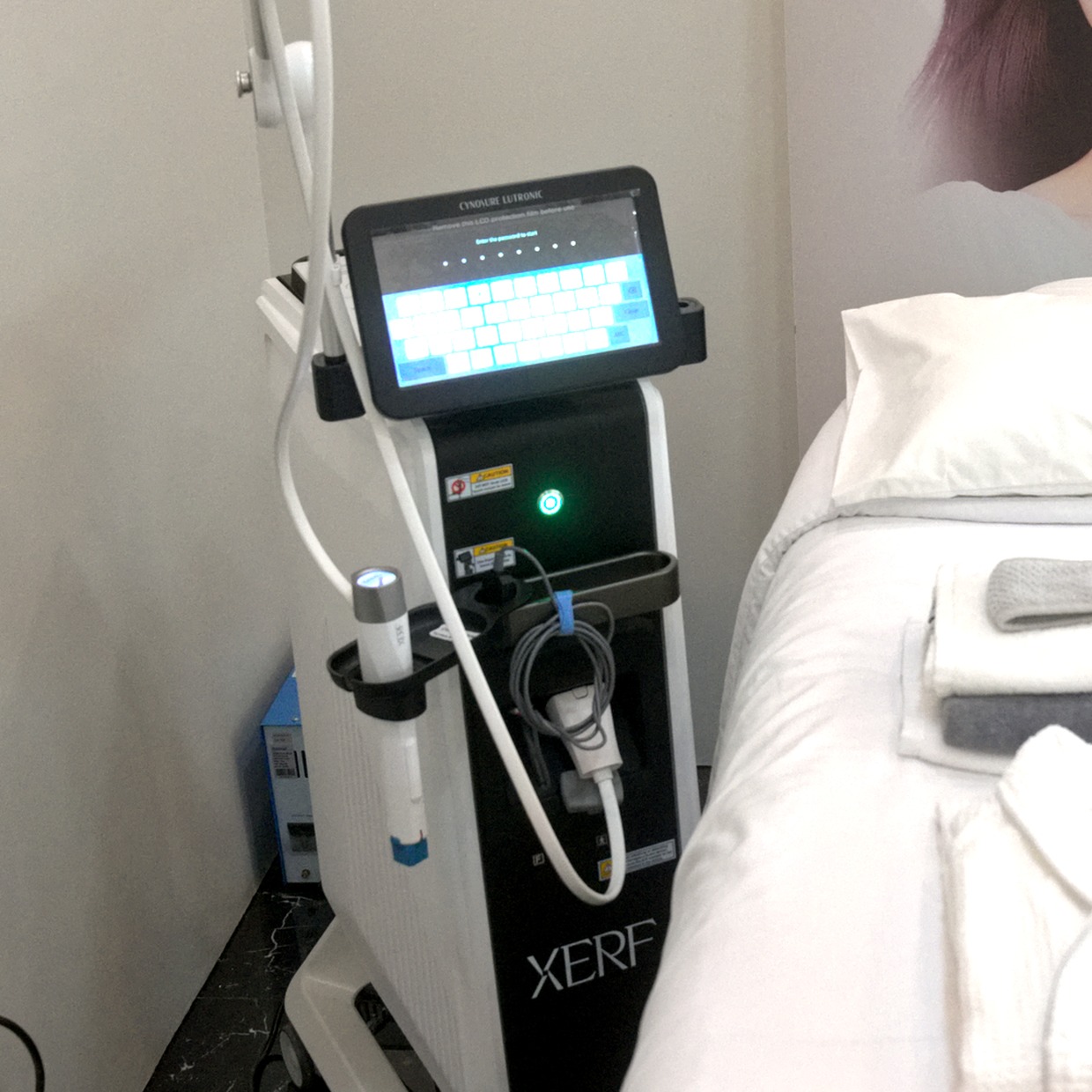 Close-up of the XERF radiofrequency machine and handpiece in a treatment room at One Nadela Medical Group Cebu