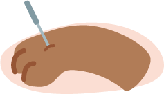 an icon demonstrating accupuncture for dogs, an example of biomechanic body work and rehabilitation