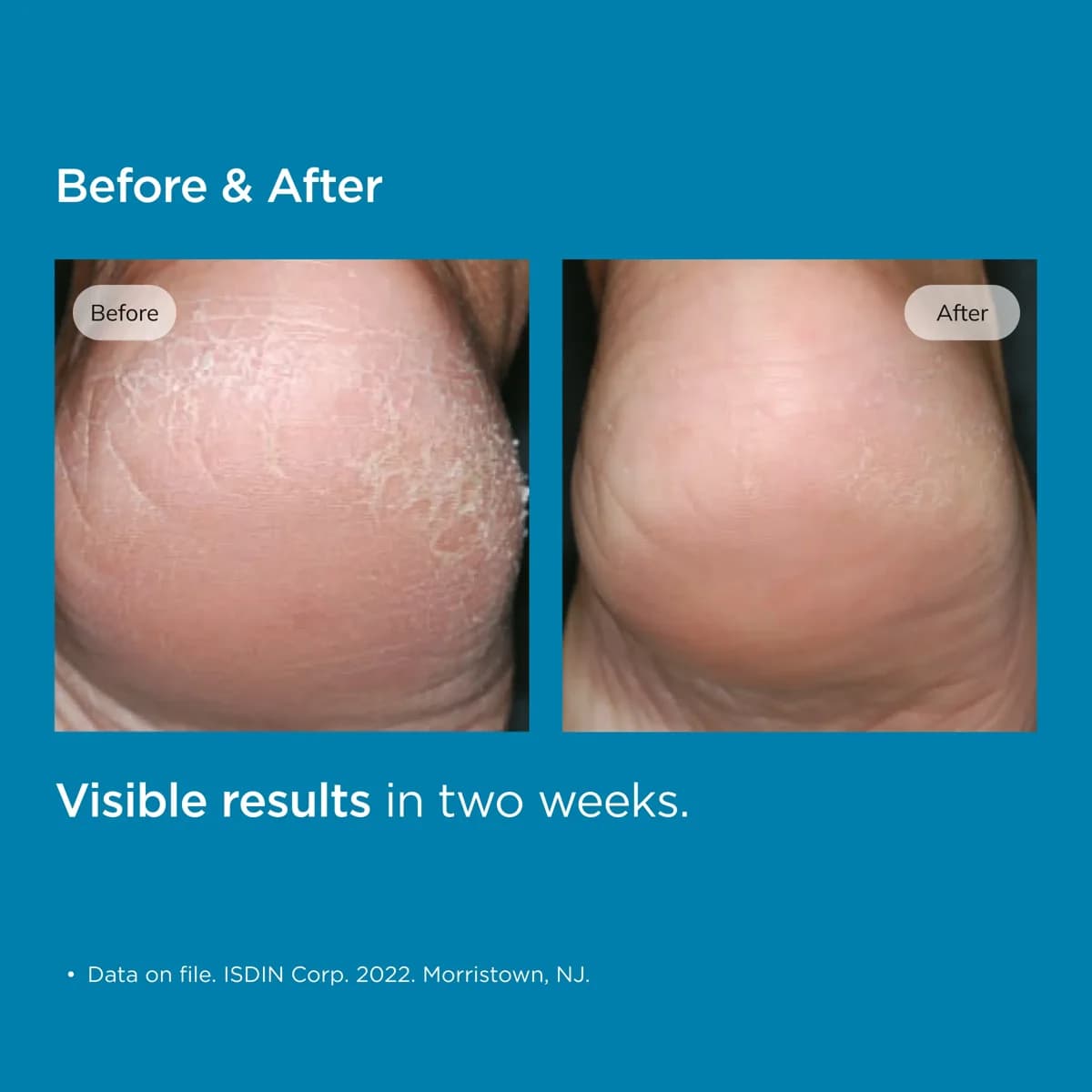 Uradin Podos Gel Oil 75ml додаткове фото #0