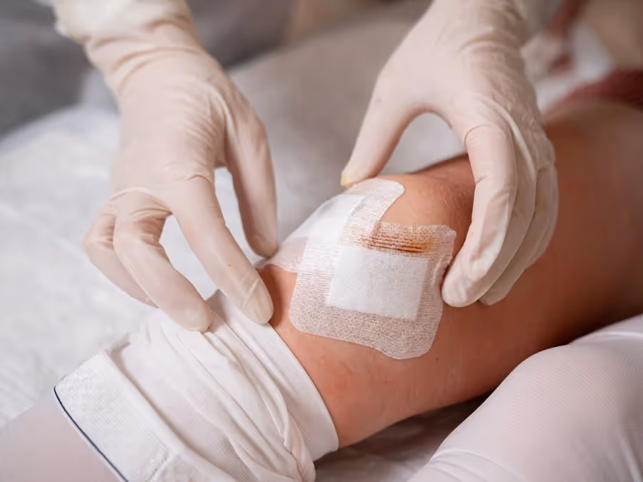 Arthroscopic Knee Surgery Settlements in Workers’ Compensation: What You Need to Know