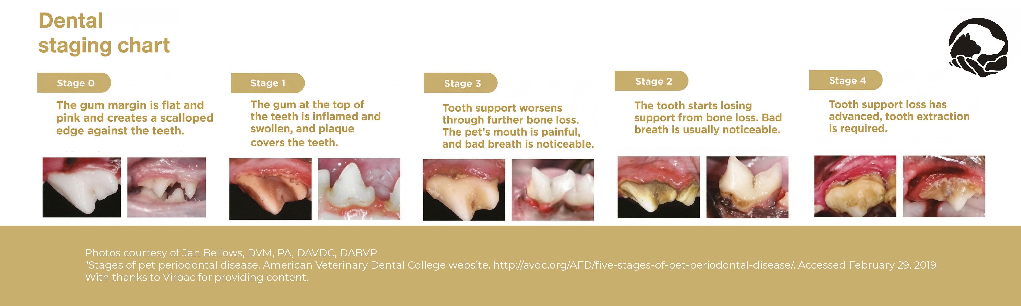 Periodontal disease stages