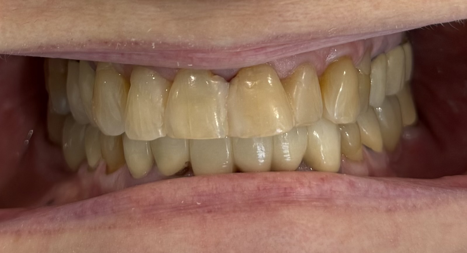 Before Image