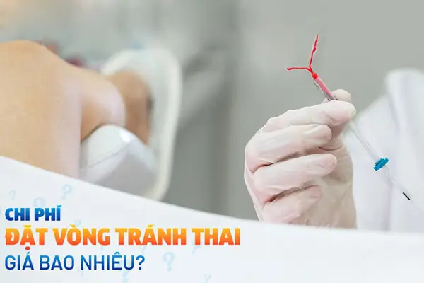 Chi phí đặt vòng tránh thai hết bao nhiêu tiền bảng giá 2025