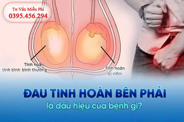 Đau tinh hoàn bên phải nguyên nhân và cách chữa trị