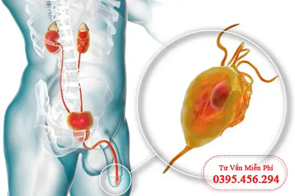 Nguyên nhân dẫn đến xuất tinh ra máu ở nam giới