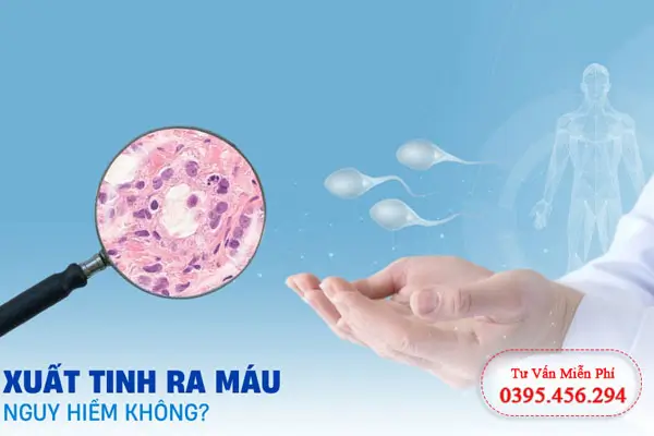 Biện pháp phòng tránh tình trạng xuất tinh kèm máu