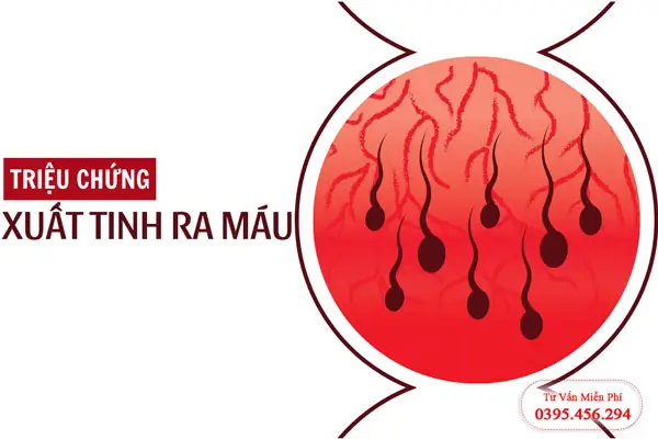 Triệu chứng xuất tinh kèm máu