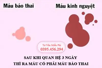 Sau khi quan hệ 3 ngày thì ra máu có phải máu báo thai