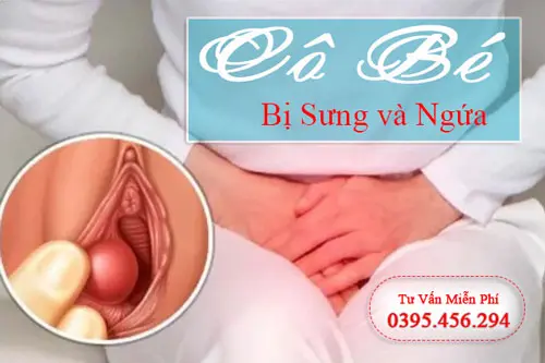 Cô bé bị sưng và ngứa dấu hiệu cảnh báo sớm cần đi khám ngay